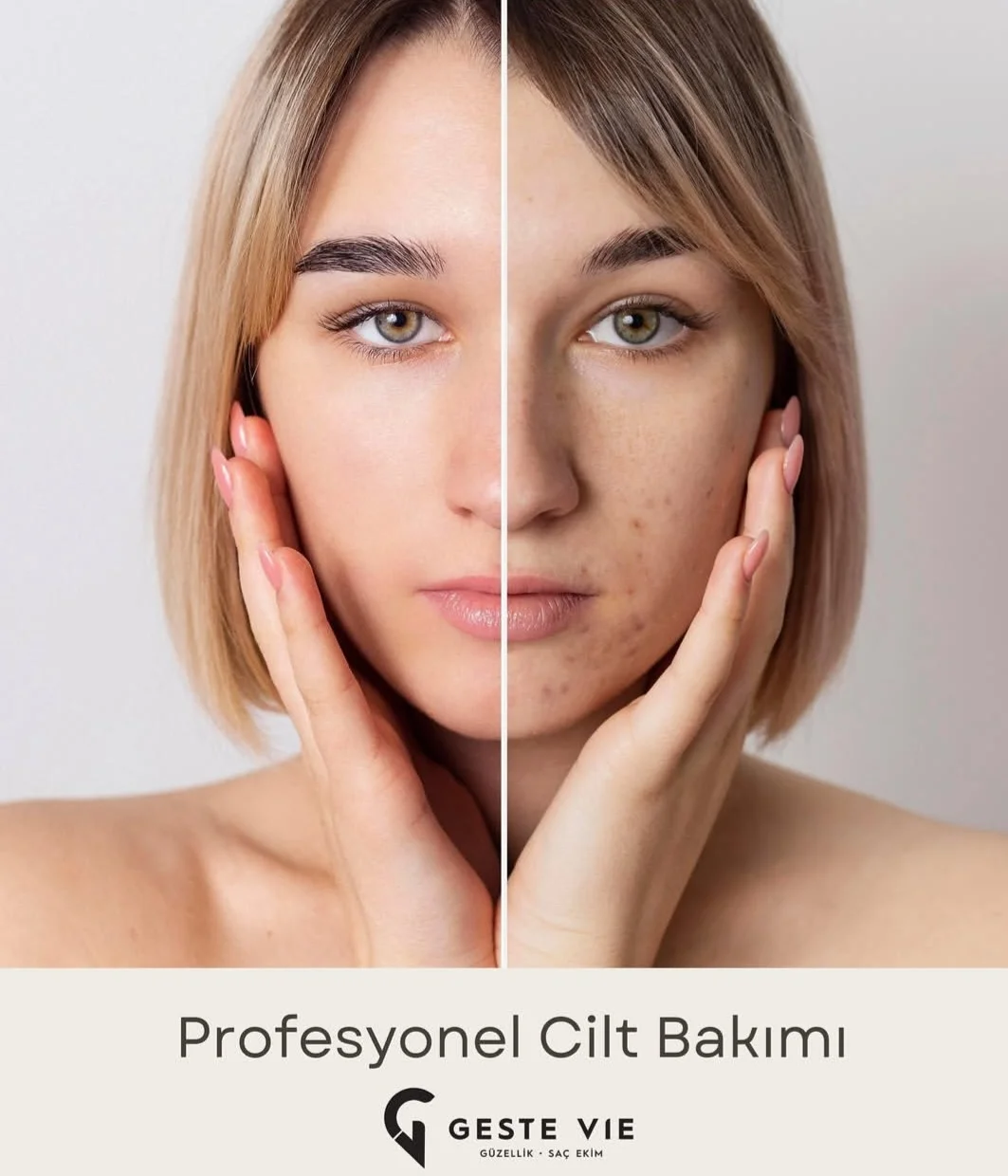 Cilt Bakimi